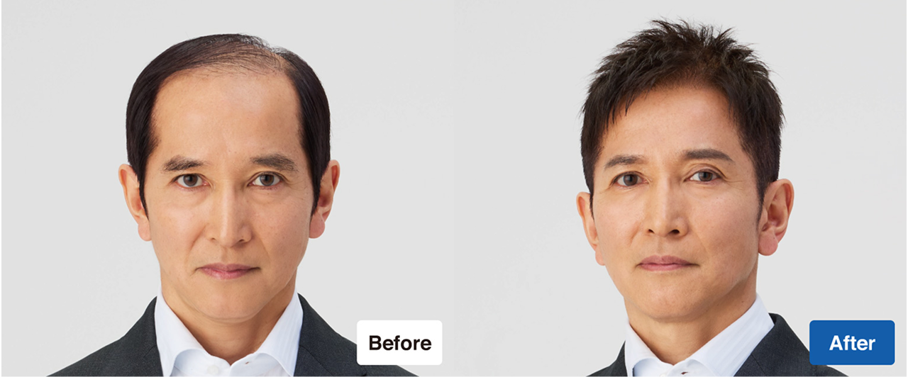 ���N�A / �w�A�E�t�H�[���C�t/ ���̑��E�B�b�O